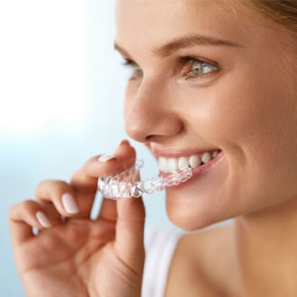 clear aligners